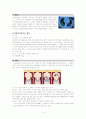 Ovary Cancer(난소암) 문헌고찰 4페이지