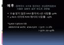 복부대동맥류 12페이지