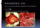 복부대동맥류 27페이지