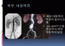 복부대동맥류 32페이지