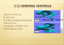 (성인-수술실컨퍼) 뇌실 - 복강간 단락수술(사진 많음, 동영상 있음) 2페이지