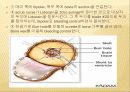 (성인-수술실컨퍼) 뇌실 - 복강간 단락수술(사진 많음, 동영상 있음) 15페이지