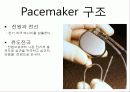 pacemaker 4페이지
