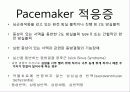 pacemaker 11페이지