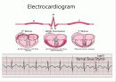 pacemaker 12페이지