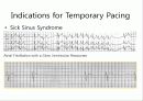 pacemaker 14페이지