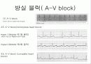 pacemaker 15페이지