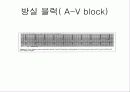 pacemaker 16페이지