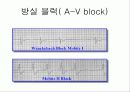 pacemaker 17페이지
