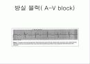 pacemaker 18페이지