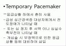 pacemaker 19페이지