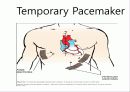 pacemaker 21페이지