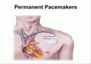 pacemaker 27페이지