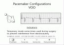 pacemaker 30페이지
