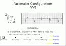 pacemaker 31페이지