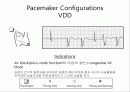 pacemaker 33페이지