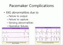 pacemaker 35페이지