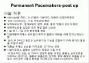 pacemaker 37페이지
