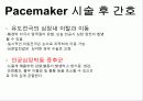 pacemaker 39페이지