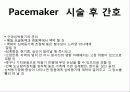 pacemaker 41페이지
