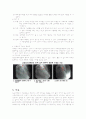 심근경색 간호진단  7페이지