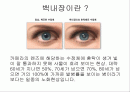 백내장 교육보고서 2페이지