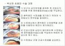 백내장 교육보고서 11페이지