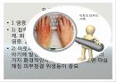 병태생리학 감각기계질환  14페이지