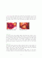[논문] 뇌종양 환자의 간호 17페이지