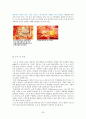 [논문] 뇌종양 환자의 간호 32페이지
