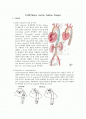 IABP(Intra Aortic ballon Pump)  1페이지
