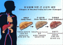 알콜중독 가정 사례관리 파워포인트 PPT 프리젠테이션 2페이지