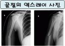 응급처치보건교육ppt 24페이지