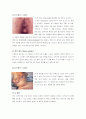 매 독 (Syphilis) 2페이지