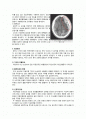 응급실 케이스(ER case study)- 경막하출혈(Subdural Hemorrhage) 2페이지