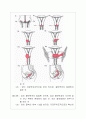 cervical cancer(자궁경부암)case study 5페이지