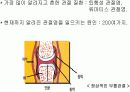   관절염의원리및항관절염성소재탐색과연구  6페이지