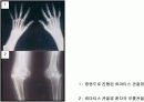   관절염의원리및항관절염성소재탐색과연구  24페이지
