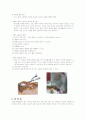 Rt. Inguinal Hernia 케이스 9페이지