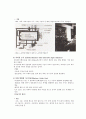 유행성 이하선염 (볼거리) 8페이지