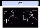 말초관절유동술 15페이지