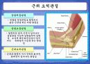 주관절과 전완복합체 7페이지