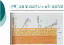 피하 피내 근육주사 비경구 투여 방법 2페이지