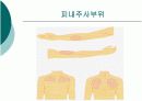 피하 피내 근육주사 비경구 투여 방법 5페이지