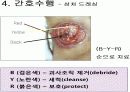 상처간호 간호수행 방법 평가 59페이지