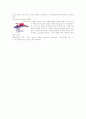 충수돌기 절제술 appendectomy 간호사례연구 12페이지