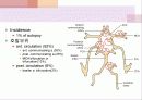  SAH disease review ppt 4페이지