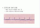 심전도[Electrocardiogram , ECG, 心電圖, EKG]  19페이지