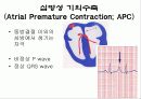 심전도[Electrocardiogram , ECG, 心電圖, EKG]  41페이지