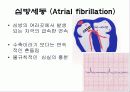심전도[Electrocardiogram , ECG, 心電圖, EKG]  48페이지
